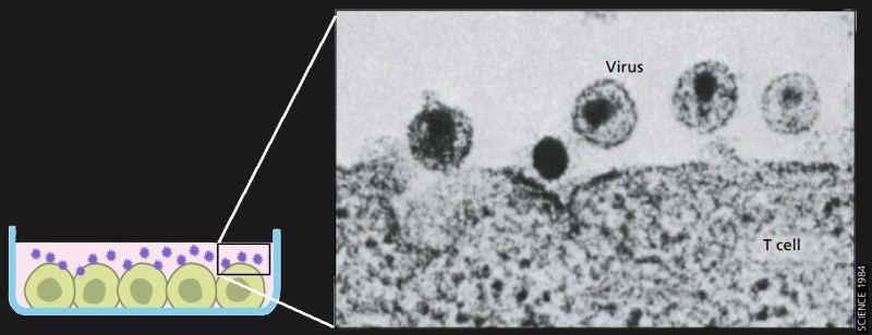 Electron microscope image of HIV budding from T cells